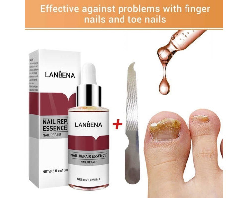 Противогрибковые средства для ногтей LANBENA Nail Repair Essence, 15мл (е190)